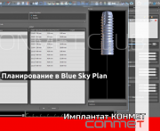 Планирование дентальной имплантации в программе Blue Sky Plan на имплантатах КОНМЕТ! Москва