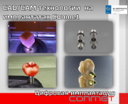 Применение CAD/CAM технологий при работе на имплантатах Conmet Москва