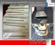 Титановые миКРО - пластины КОНМЕТ для челюстно-лицевой хирургии Москва
