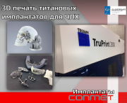 3D печать титановых имплантатов для ЧЛХ Москва